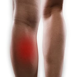 Calf & Shin Injuries