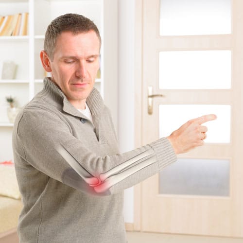 Elbow Arthritis