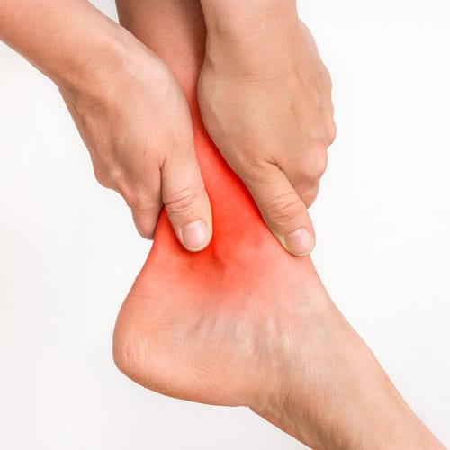 High Ankle Sprain