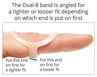 Oval-8 Finger Splints