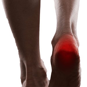 Plantar Fasciitis & Heel Pain
