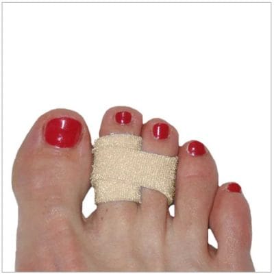 toe loop for subluxed toe
