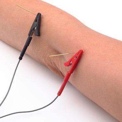Cefar Professional TENS / NMES Unit - Image 9