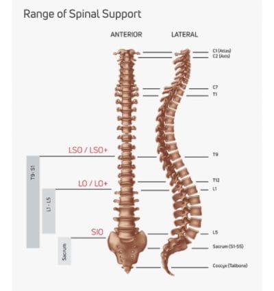 Donjoy IsoForm SIO Belt - Image 4