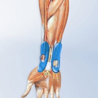 Bauerfeind ManuTrain Wrist Brace - Image 3