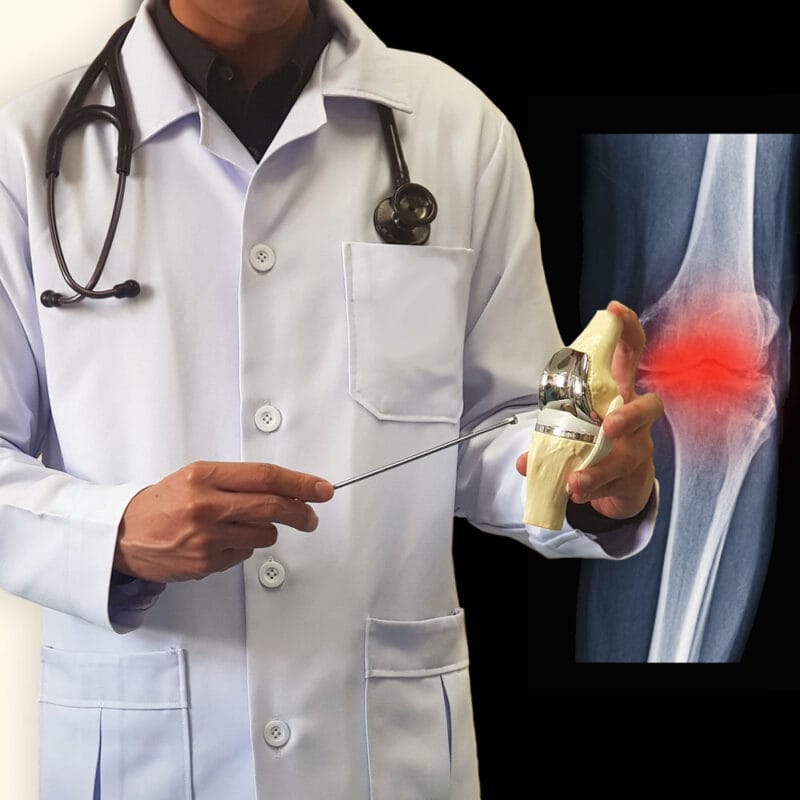 Medial or lateral compartment knee unloader brace?