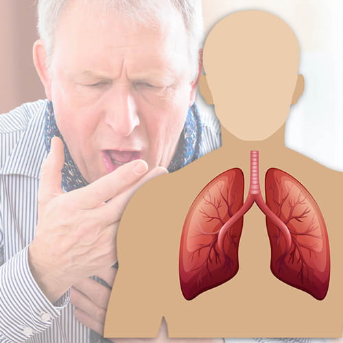 COPD